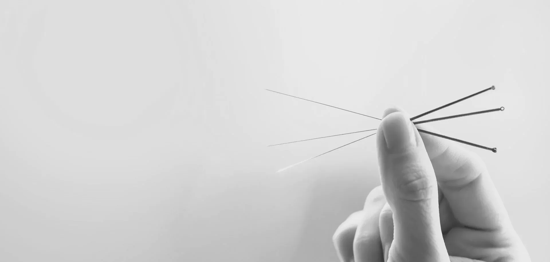 Apex acupuncture center and pain clinic Best Acupuncture Centre in Lucknow