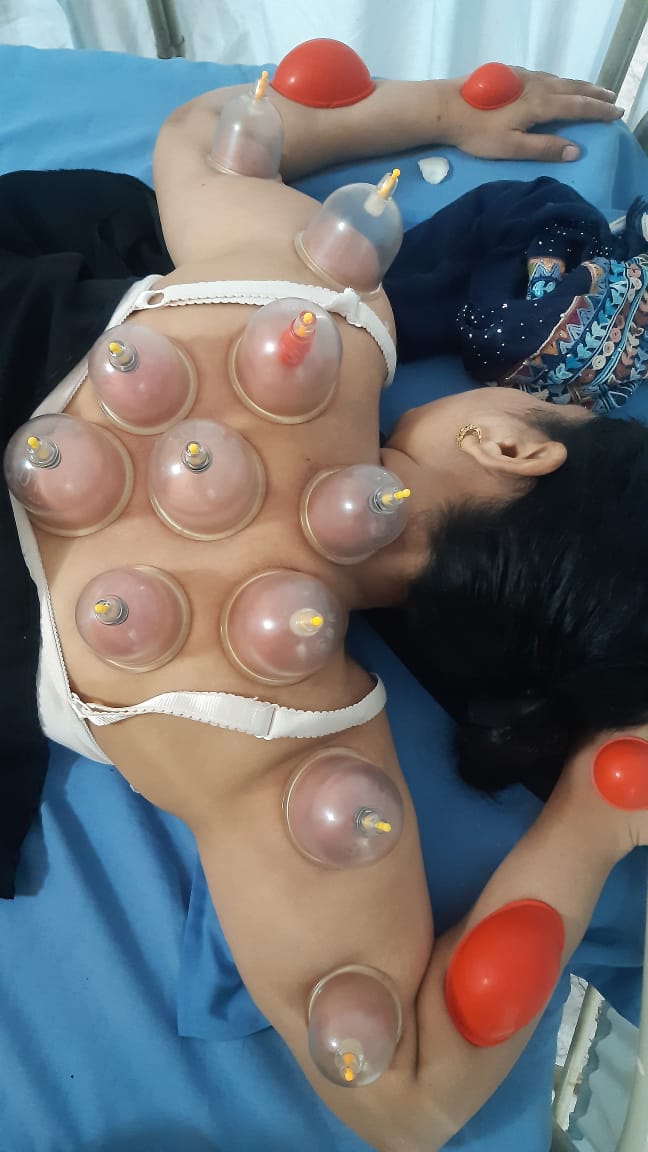Hijama